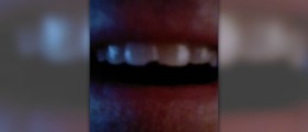 Chipped tooth repair cost