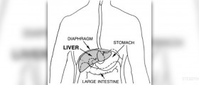 Chronic cirrhosis of the liver