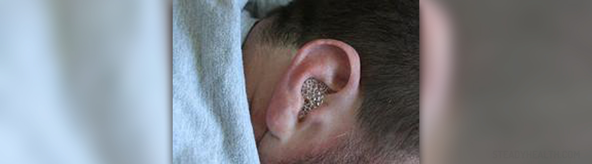 Chronic Ear Infections General Center SteadyHealth