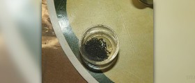 Chronic lead poisoning
