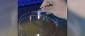 What is frozen embryo transfer (FET)?