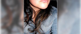 Cold sore natural cure