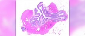 Colon cleanse side effects