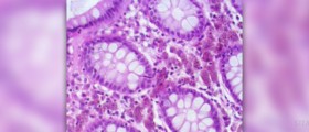 Colon cleansing procedure