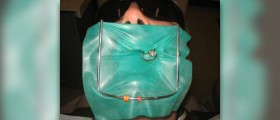 Common root canal problems