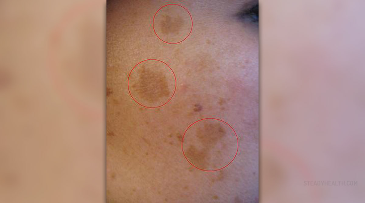 common-skin-conditions-during-pregnancy-women-s-health-articles