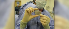 Complications after cardiac surgery