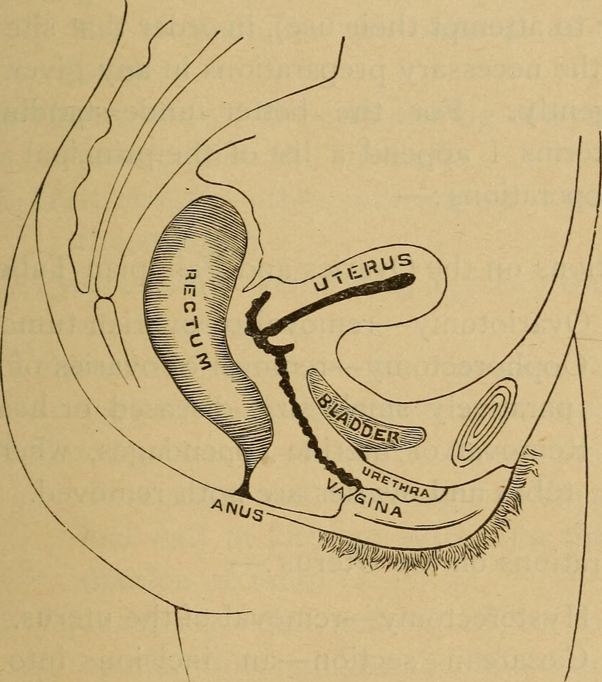 complications-after-oophorectomy-general-center-steadyhealth