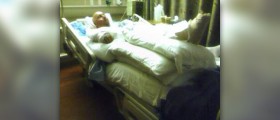 Complications after surgery