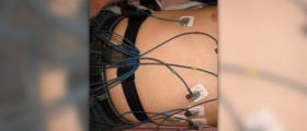 Complications of atrial fibrillation