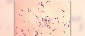 Complications of diphtheria