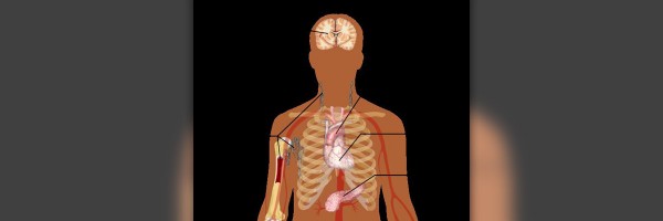 Complications of fibroadenoma