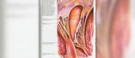 Complications of mitral regurgitation