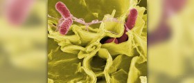 Complications of salmonella