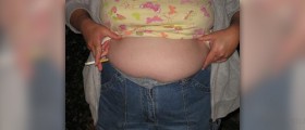 Compulsive overeating disorder