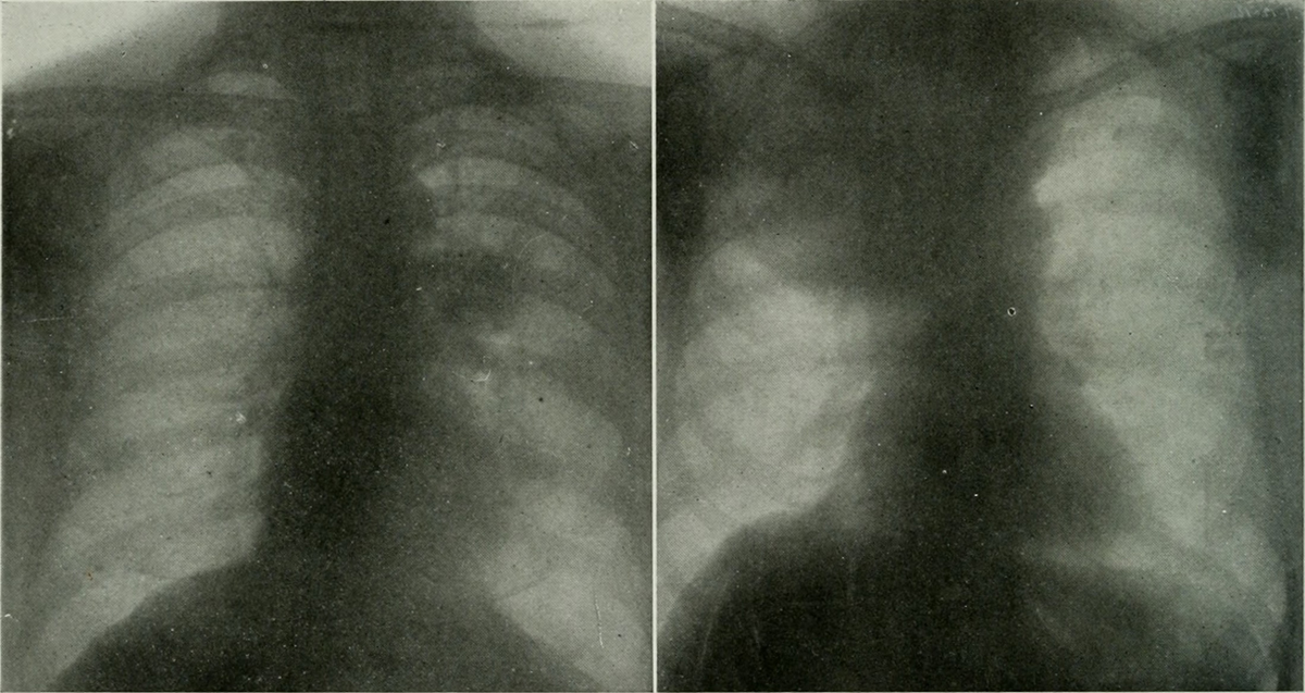 Chest congestion symptoms General center