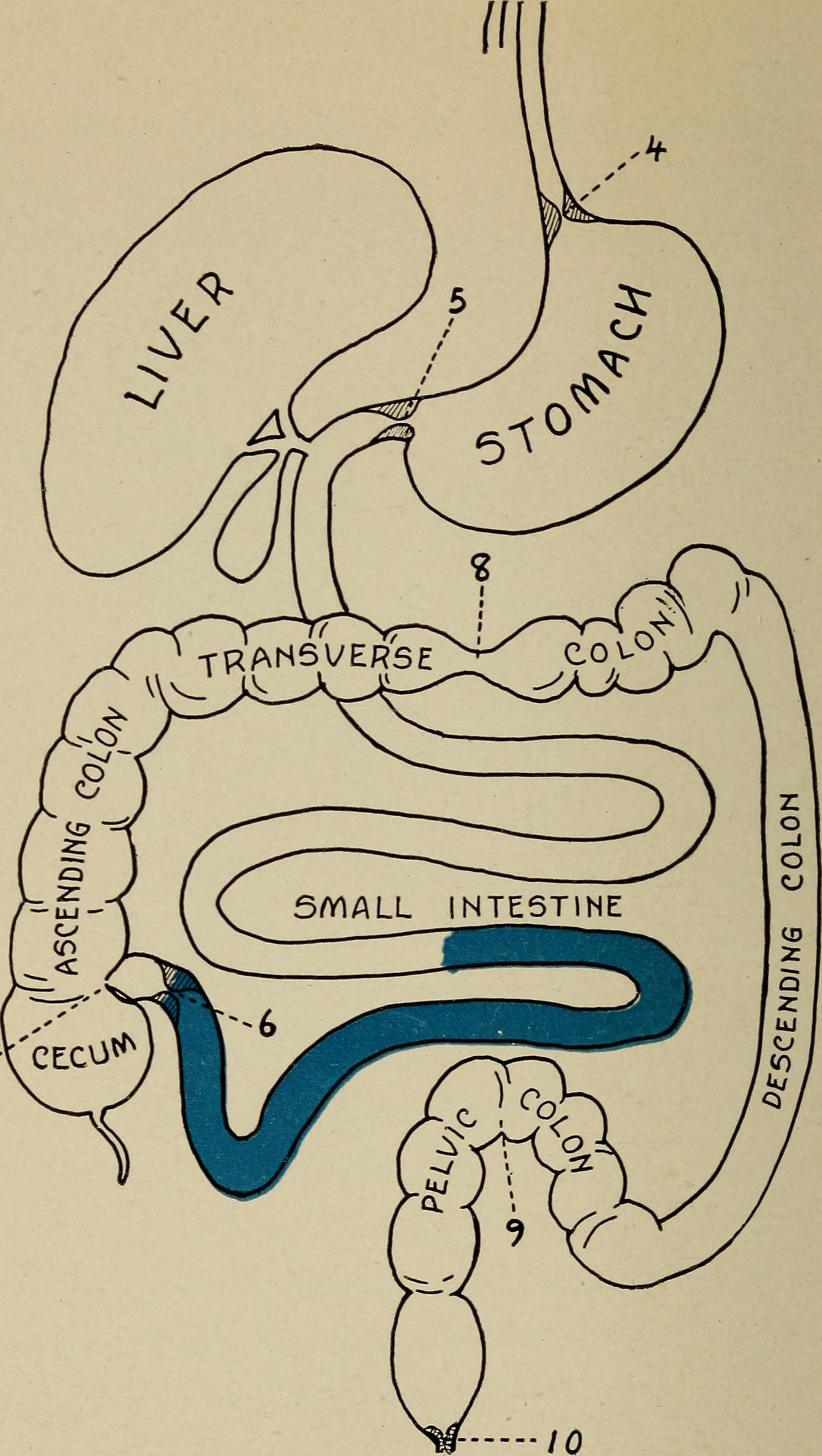 difference-between-irritable-bowel-syndrome-ibs-and-ulcerative-colitis