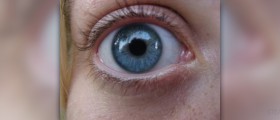 Contact lens problems