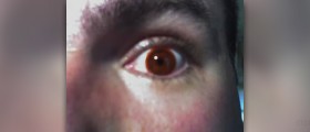 Contact lenses for astigmatism