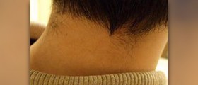 Cracking neck muscles