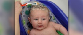Cradle cap home treatment