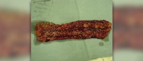 Crohn's disease drugs
