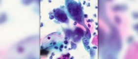 Cure for oral herpes