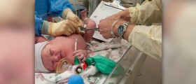 Cord blood banking procedure