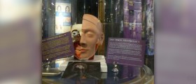 DBS surgery for dystonia