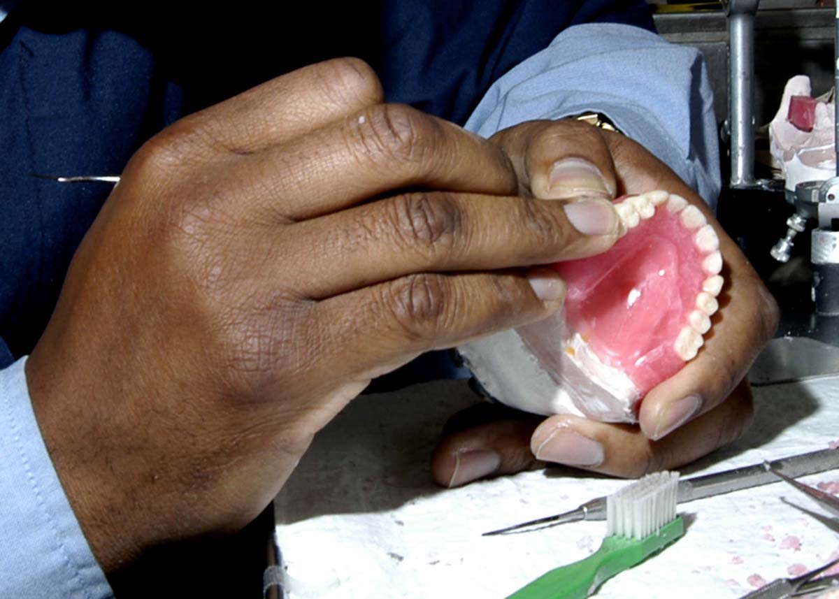 False teeth - types of partial dentures for tooth loss | General center