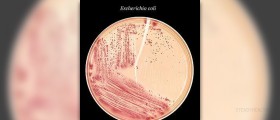 Description of Escherichia coli dangers