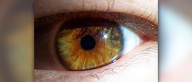Diabetic eye problems