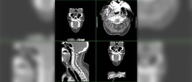 Diagnos tool: CT head scan
