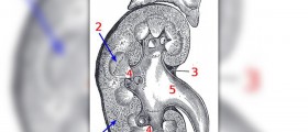 Dialysis before transplant