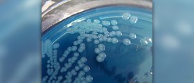 Diarrhea from bacteria