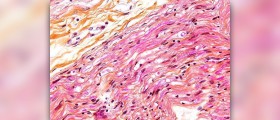 Digestion and type 2 diabetes