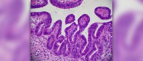 Dilation of cervix during labour