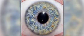 Dilation of pupils