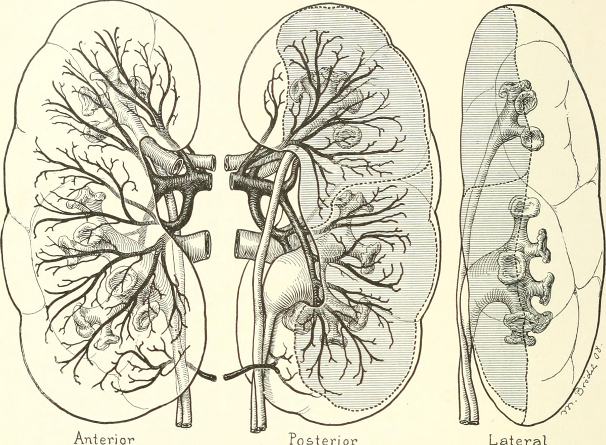 erectile-dysfunction-and-kidney-disease-urinary-tract-issues-articles