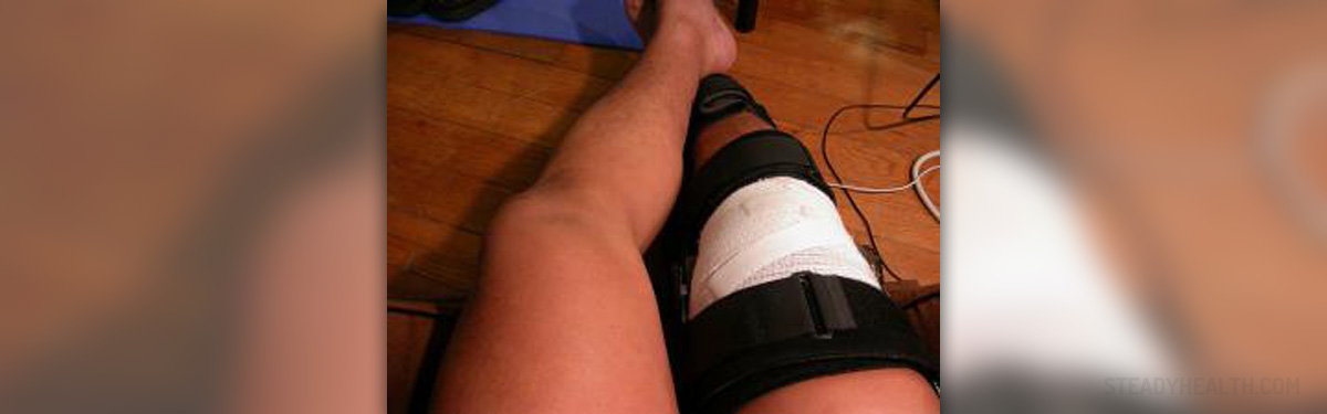 dislocated knee recovery time