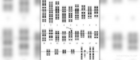 Disorder caused by trisomy