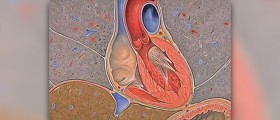 Disorder of the cardiovascular system