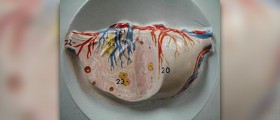 Disorder of the endocrine system
