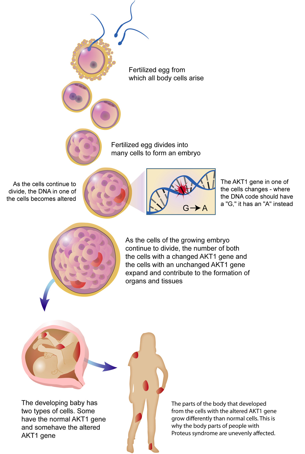 research on down syndrome has established that