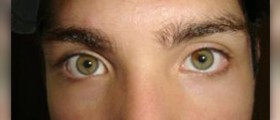 Dry eyes medication: severe dry eyes