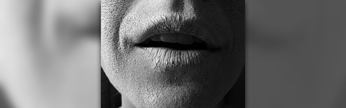 dry-lips-causes-general-center-steadyhealth