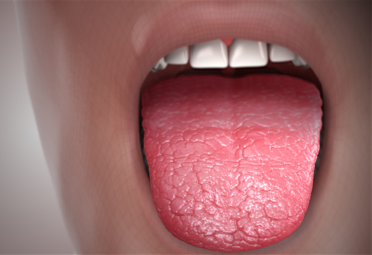 dry mouth symptoms