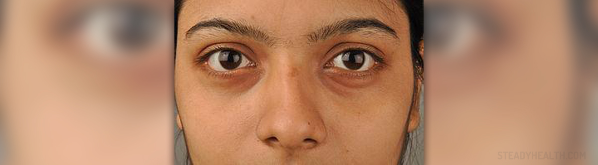 dry-skin-around-eyes-cure-skin-hair-problems-articles-body