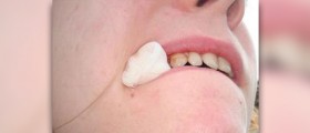 Dry socket home treatment