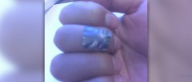 Duct tape wart removal